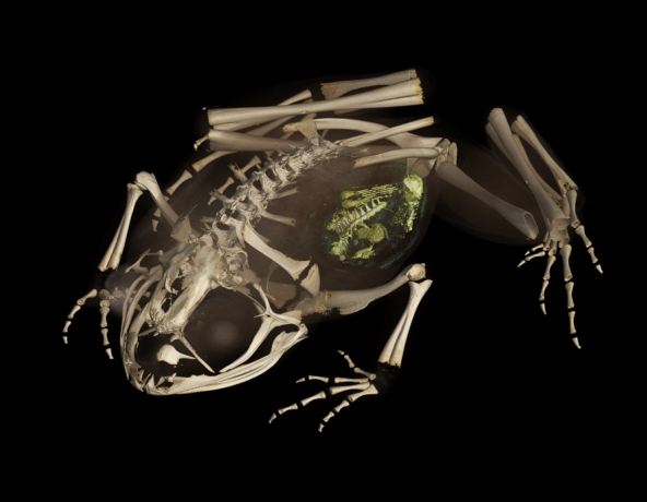 An x-ray CT scan of augustinas